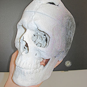 Impression 3D crâne